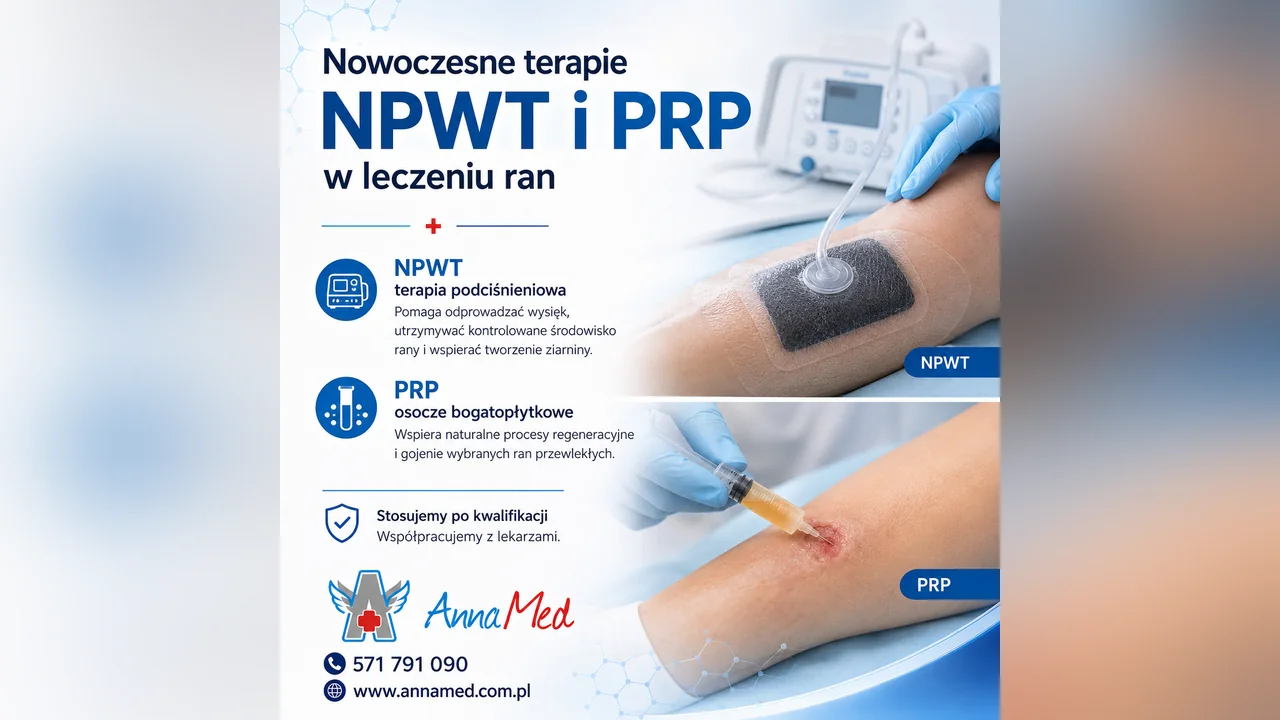 Grafika AnnaMed: Terapia NPWT i PRP – specjalistyczne wsparcie leczenia ran w AnnaMed