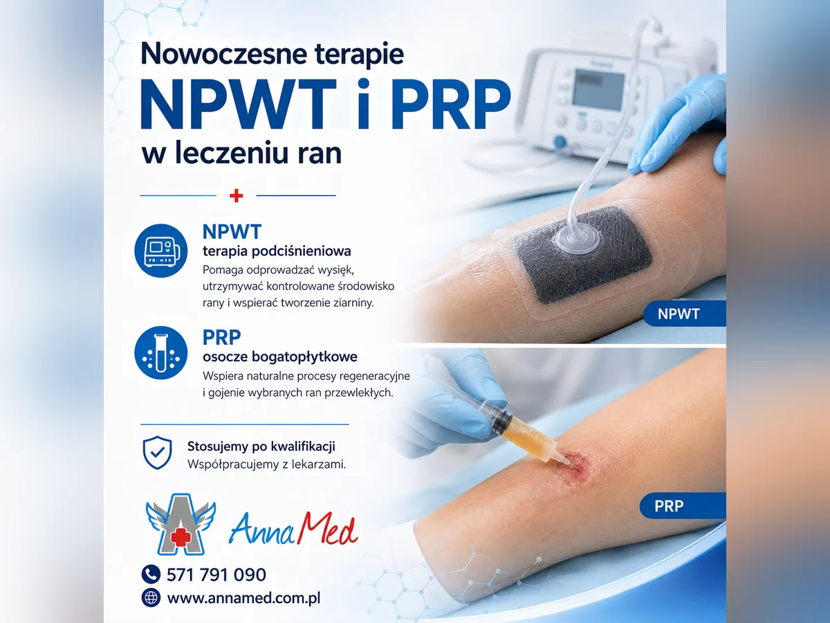 Grafika AnnaMed: Terapia NPWT i PRP – specjalistyczne wsparcie leczenia ran w AnnaMed
